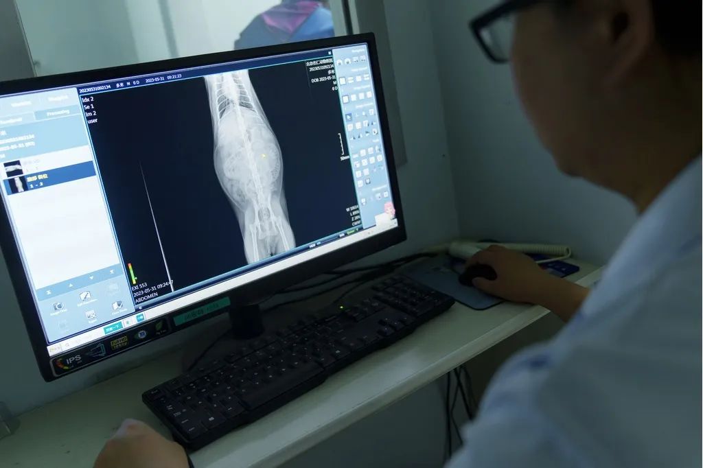 照完X光没多久就怀孕了，孩子还能要吗？放射检查后，多久备孕才安全？