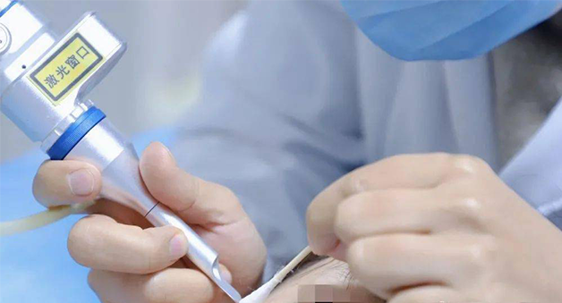 二氧化碳激光治疗