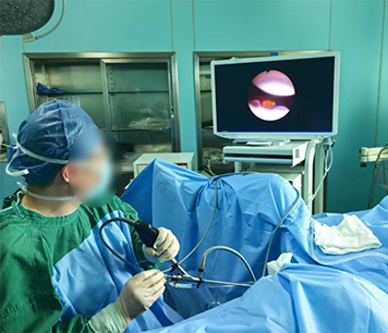 输尿管软镜钬激光碎石取石术