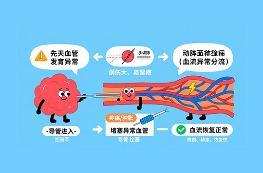 脉管异常的介入治疗