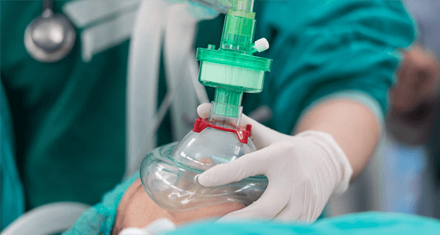 麻醉方法及其分类